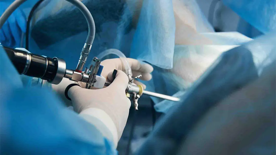 Laparoscopic surgery
