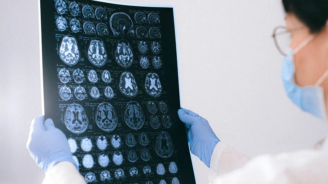 Looking at a brain scan