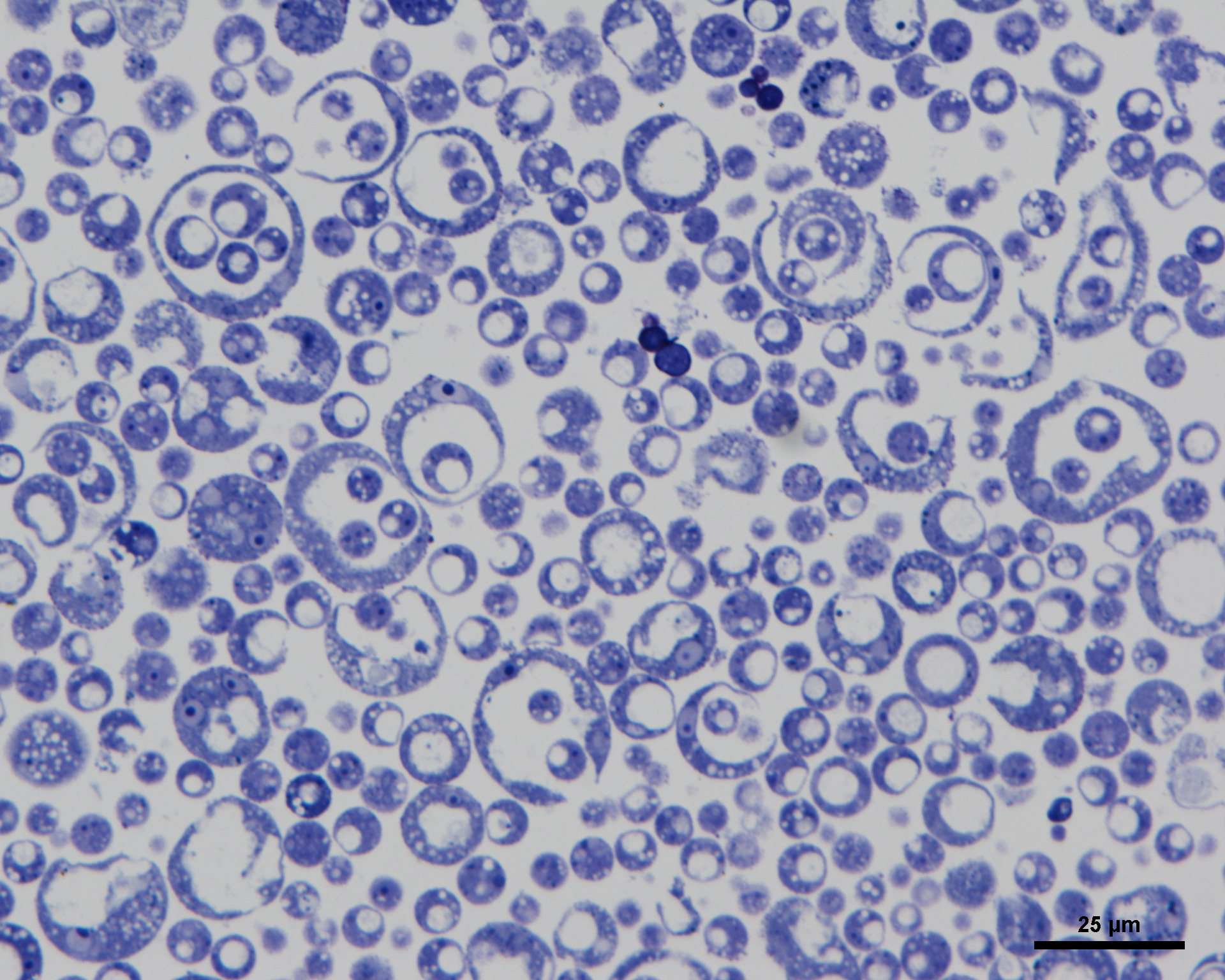 Blue cells against a white background with a scale 