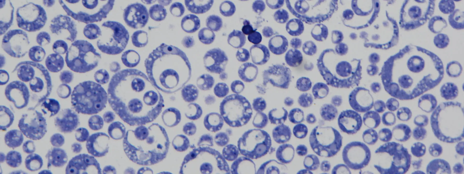 Blue cells against a white background with a scale