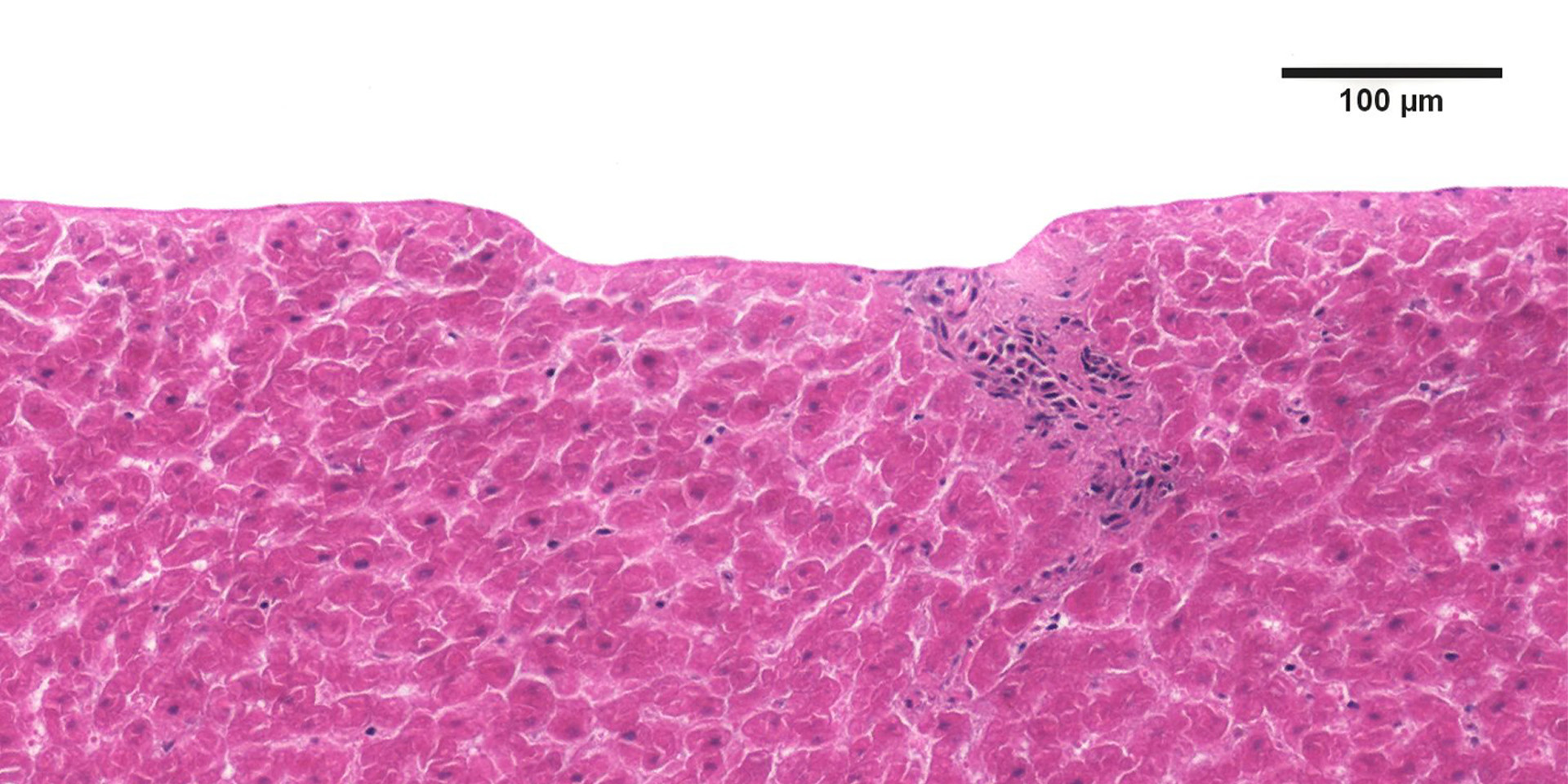 Swathe of pink tissue, marbled effect, with smooth surface of optimised ablation 