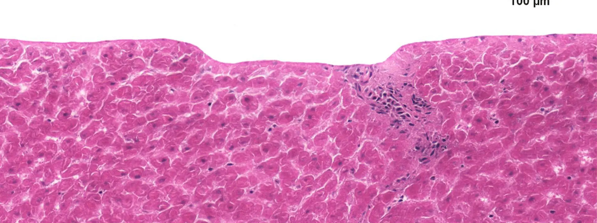 Swathe of pink tissue, marbled effect, with smooth surface of optimised ablation