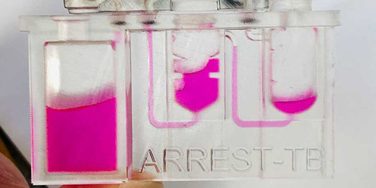 Microfluidics Arrest TB - pink fluid in container