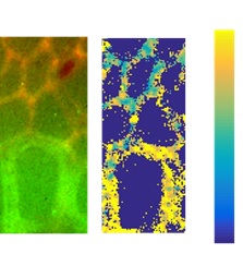 urface Enchanced Raman Spectroscopy 